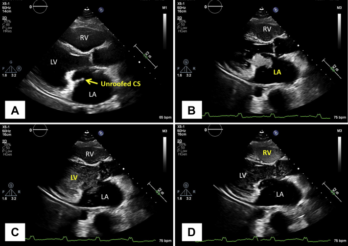 Figure 4