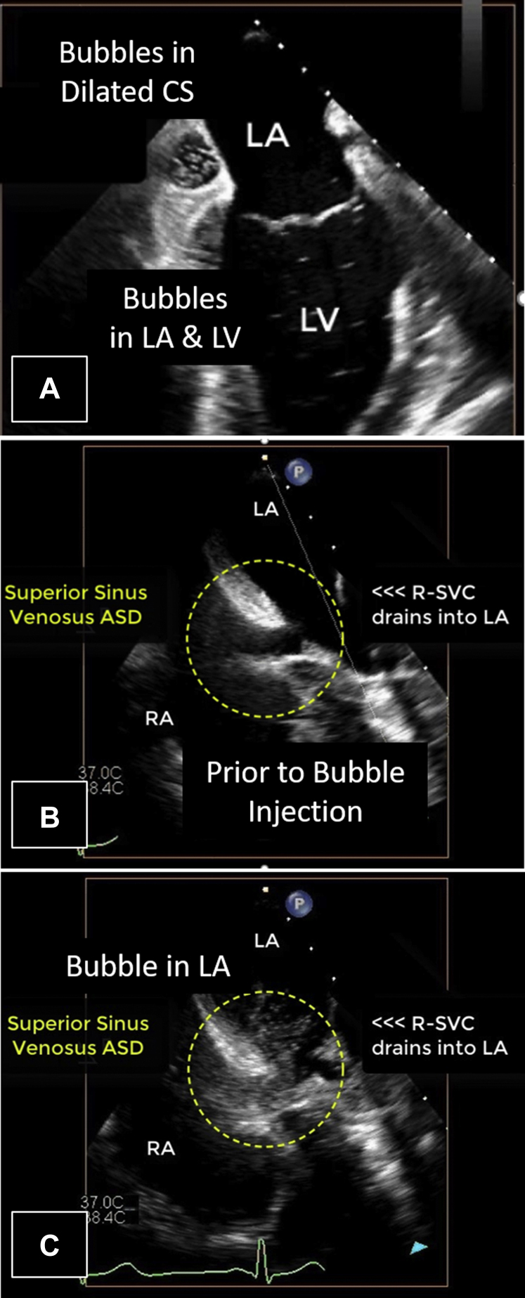 Figure 12