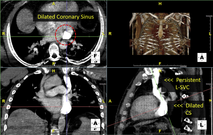 Figure 9