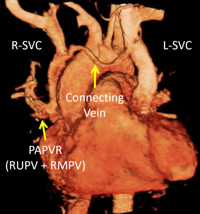 Figure 11