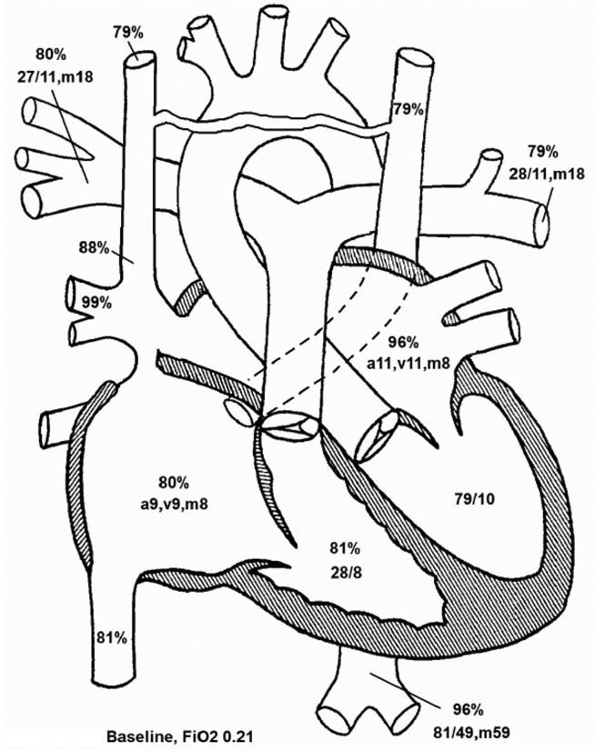 Figure 13