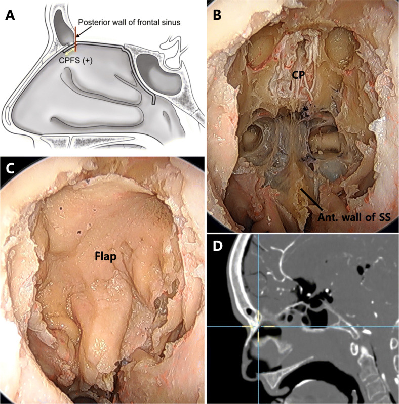 Fig. 2