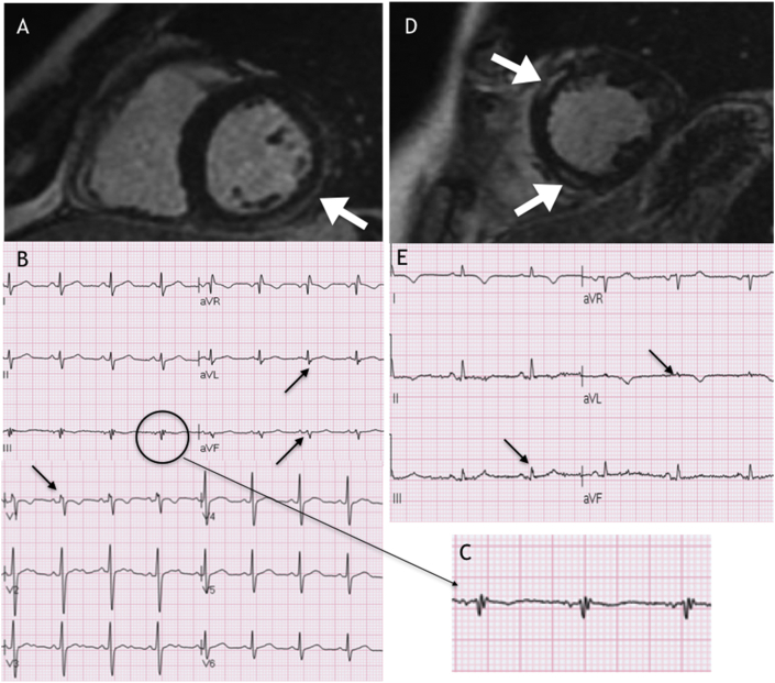 Fig. 1