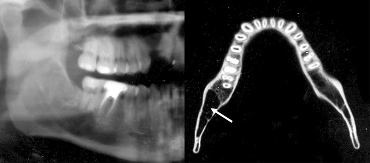 Fig. 3