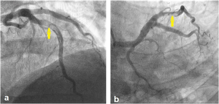 Figure 2