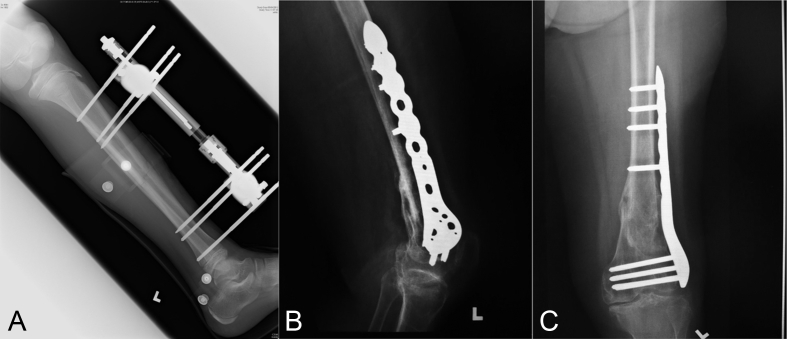 Figure 2