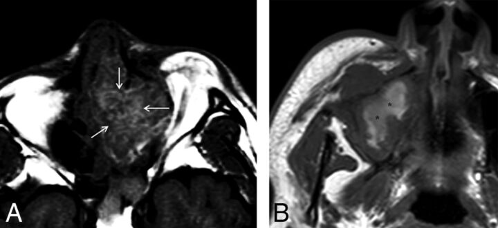 Fig 1.