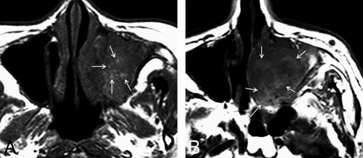 Fig 4.