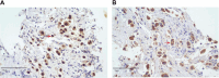 Microscopic images labeled A and B show stained tissue samples. Both depict clusters of cells with brown nuclei and blue-stained cytoplasm. Red arrows point to specific cells. The scale bars measure 50 micrometers.