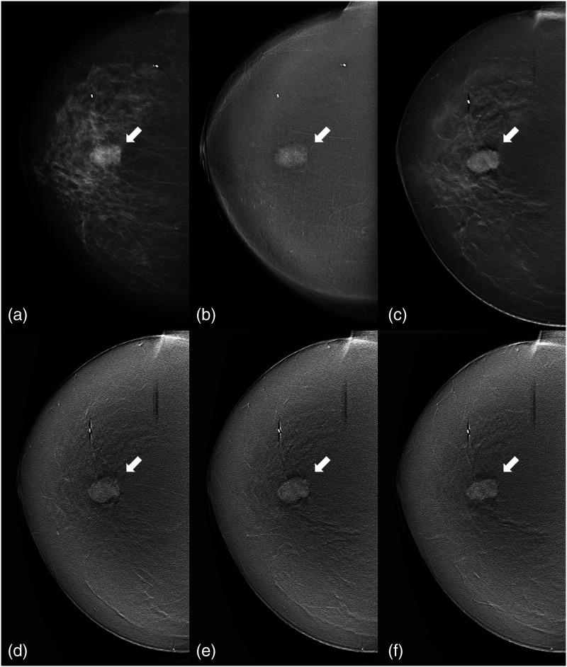 Fig. 6