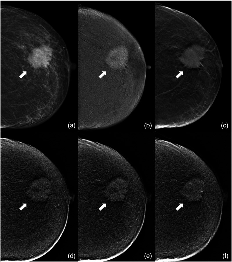 Fig. 7