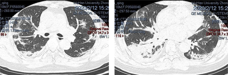 Fig. 1