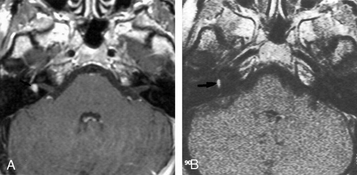 Fig 2.