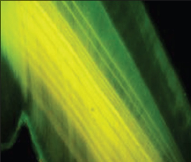 Figure 4b: Ground section tooth under fluorescent microscopy
x10 magnification shows alternative fluorescent bands following
the contour of teeth.