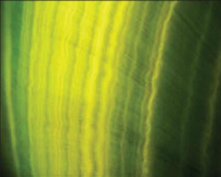 Figure 5b: Ground section tooth under fluorescent microscopy
x40 magnification shows alternative fluorescent wavy bands.