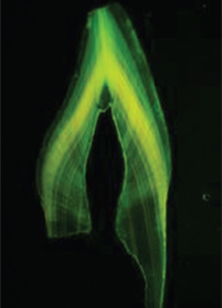 Figure 2: Ground section tooth under fluorescent microscopy
x2 magnification shows distinct continuous fluorescent bands.