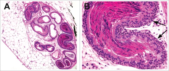 Figure 39.