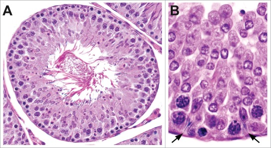 Figure 13.