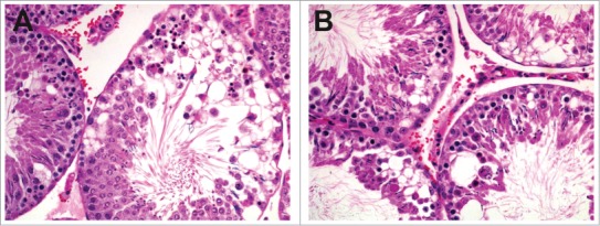 Figure 43.