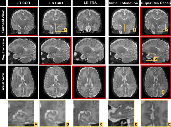 FIGURE 4