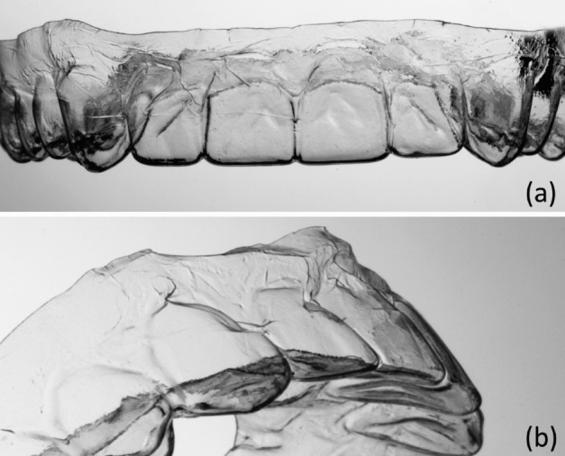 Figure 5. Frontal (a) and tilted (b) view of a 0.3-mm-thick aligner after thermoforming. In particular, the thin areas below the front teeth were deformed during removal from the plaster model.