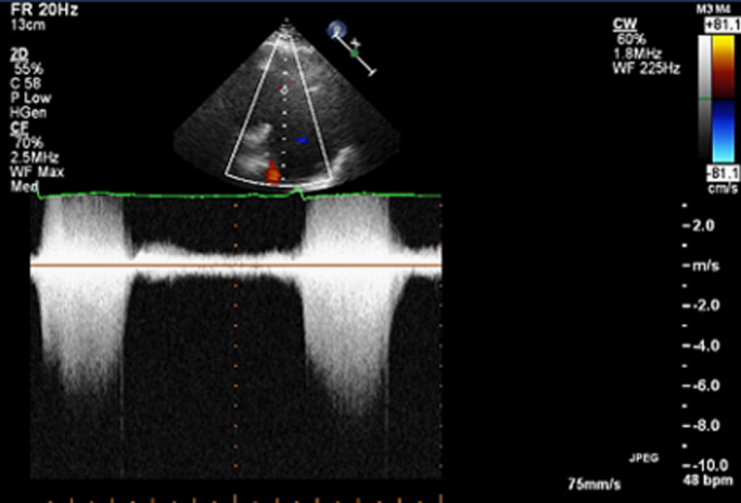 Fig. 3