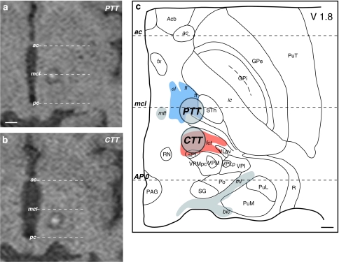 Fig. 14