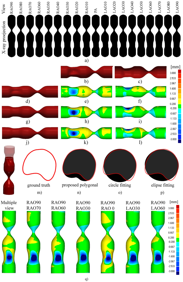 Figure 14