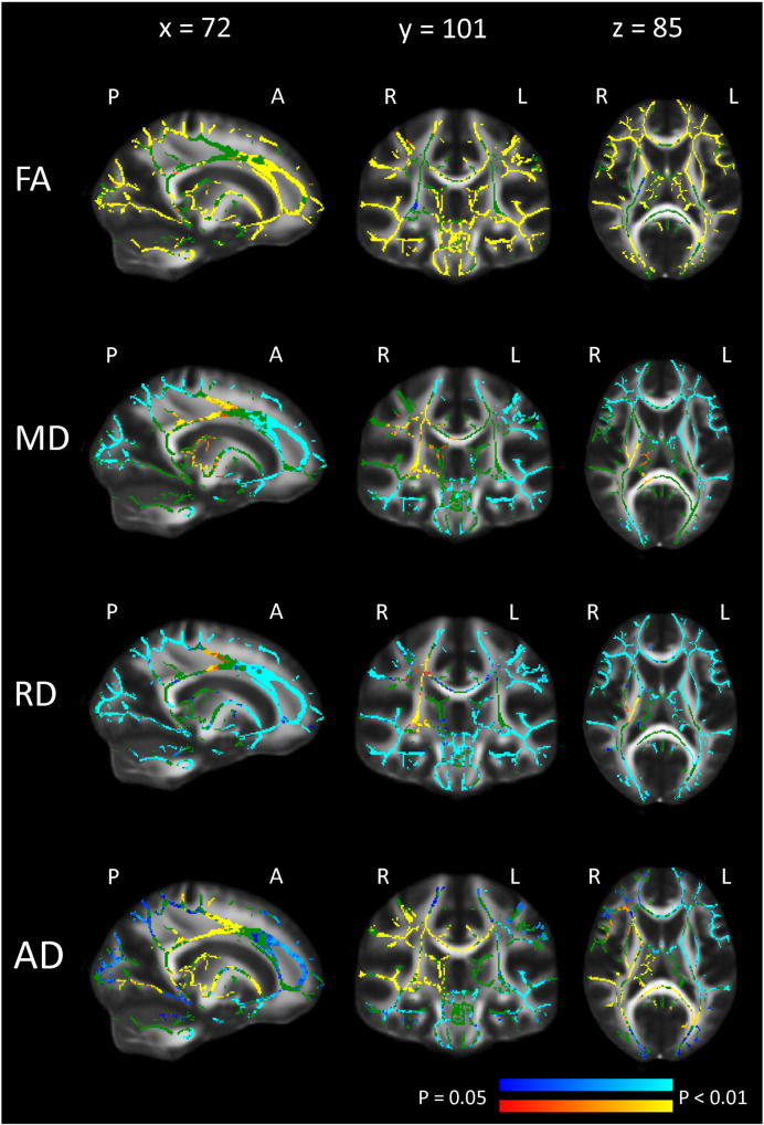 Fig. 1