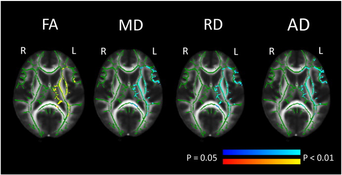 Online Supplementary Fig. 1