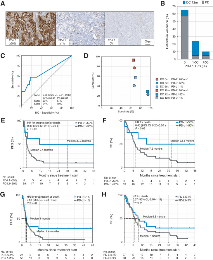 Figure 4. Association of PD-L1 with long-term benefit and survival compared with PD-1T TILs. A, IHC analysis of PD-L1. Example of NSCLC tumors with ≥50%, ≥1%, and 0% PD-L1 expression (PD-L1 TPS), respectively. B, Percentage of patients with ≥50% (n = 8), 1–50% (n = 19), and 0% PD-L1 TPS (n = 50) in pretreatment samples showing DC 12 m or PD in the validation set (n = 77). C, ROC curve for predictive value of PD-L1 TPS for DC 12 m (AUC, 0.68; 95% CI, 0.51–0.86) in the validation set (n = 77). D, Sensitivity and specificity of PD-L1 TPS 50% and 1% for DC 6 m and 12 m in comparison with PD-1T 90 per mm2 in the validation set (n = 77). E, PFS (HR, 0.36; 95% CI, 0.18–0.70; *, P = 0.03) and (F) OS (HR, 0.40; 95% CI, 0.20–0.80; P = 0.06) of patients with ≥50% versus <50% PD-L1 TPS in pretreatment samples in the validation set (n = 77). G, PFS (HR, 0.63; 95% CI, 0.38–1.03; P = 0.08) and (H) OS (HR, 0.67; 95% CI, 0.40–1.11; P = 0.14) of patients with ≥1% versus <1% PD-L1 TPS in pretreatment samples in the validation set (n = 77). Tick marks represent data censored at the last time the patient was known to be alive and without disease progression or death. P value was determined by log-rank test.