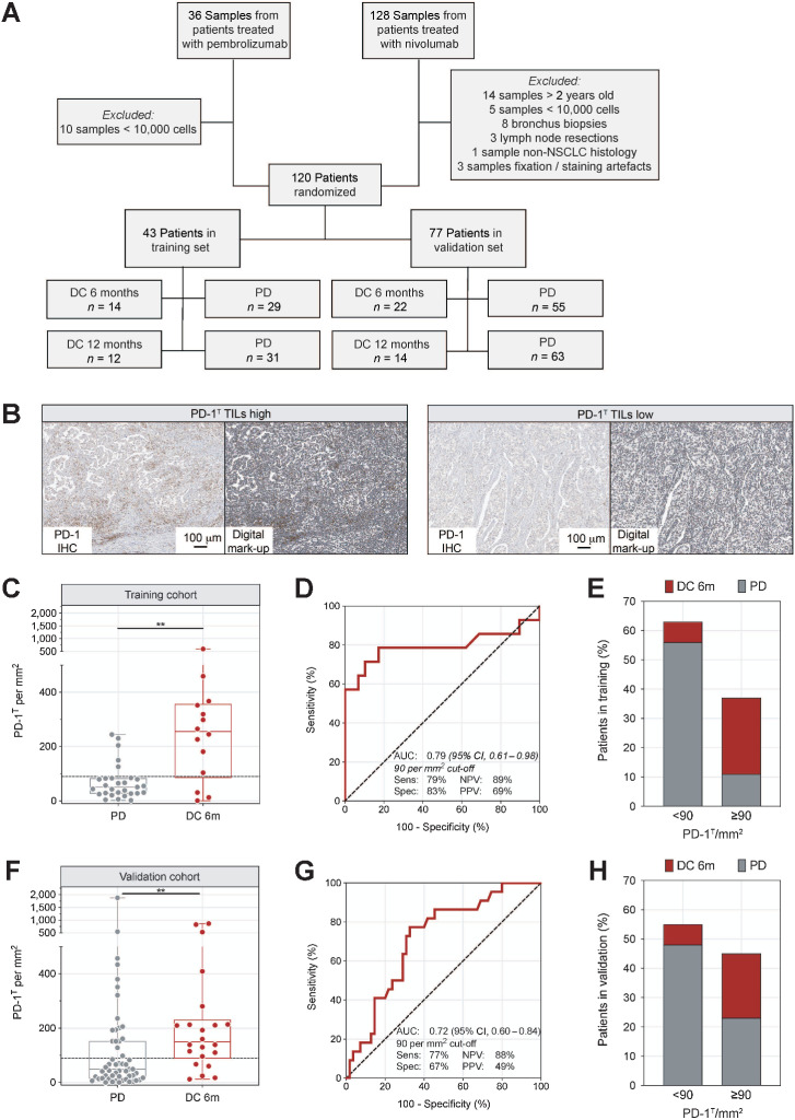 Figure 1. PD-1T TILs as biomarker for clinical outcome to PD-1 blockade in NSCLC. A, Study design for analysis of PD-1T TILs in pretreatment samples from two retrospective patient cohorts with stage IV NSCLC treated with PD-1 blockade. The training (n = 43) and validation set (n = 77) consisted each of 30% of patients with disease control at 6 months (DC 6 m) of treatment. Researchers were blinded for clinical outcome. B, Representative PD-1 IHC and digital mark-ups showing PD-1T TILs (brown) in a PD-1T TIL high and PD-1T TIL low tumor sample, respectively. C, PD-1T TILs per mm2 in pretreatment samples from patients with DC 6 m (n = 14) and PD (n = 29) in the training set (n = 43). Dashed line indicates a cut-off of 90 PD1T TILs per mm2. Medians, interquartile ranges and minimum/maximum shown in boxplots, **P < 0.01 by Mann–Whitney U test. D, ROC curve for predictive value of PD-1T TILs for DC 6 m (AUC, 0.79; 95% CI, 0.61–0.98) in the training set (n = 43). E, Percentage of patients with PD-1T high (≥90 per mm2; n = 16) and PD-1T low (<90 per mm2; n = 27) pretreatment samples showing DC 6 m or PD. F, G, Same plots as shown in C and D for patients with DC 6 m (n = 22) and PD (n = 55) in the validation set, **P < 0.01 (AUC, 0.72; 95% CI, 0.60–0.84). H, Same plot as shown in E for patients with PD-1T high (n = 35) and PD-1T low (n = 42) pretreatment samples in the validation set (n = 77).