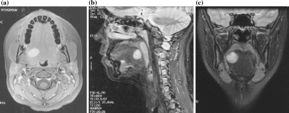 Fig. 1