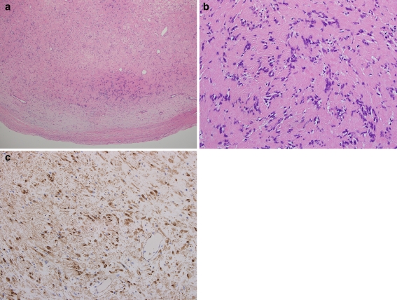 Fig. 2