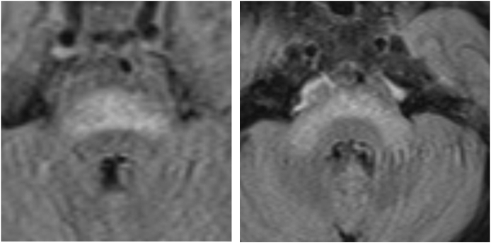 Fig. 3