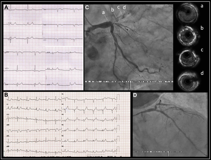 Figure 2