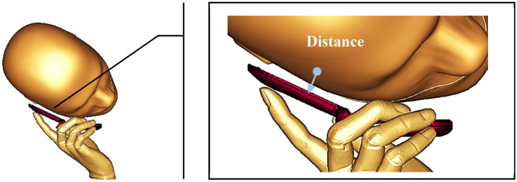 Figure 9