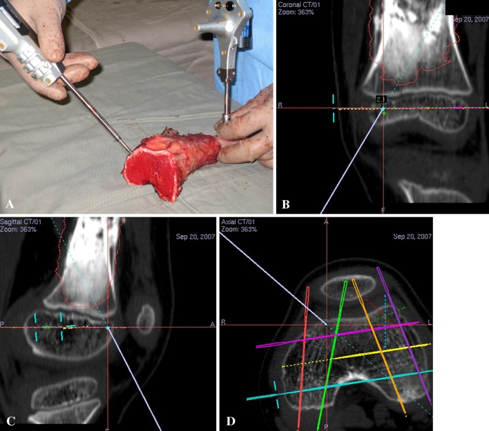 Fig. 7A–D