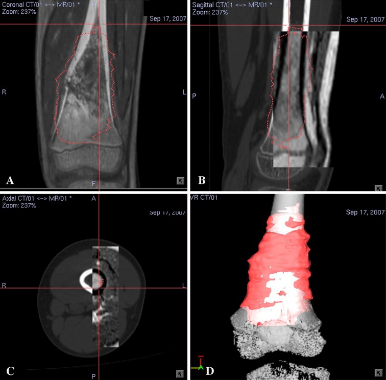 Fig. 1A–D