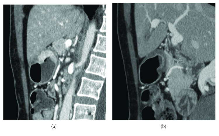 Figure 9