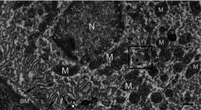 Figure 13