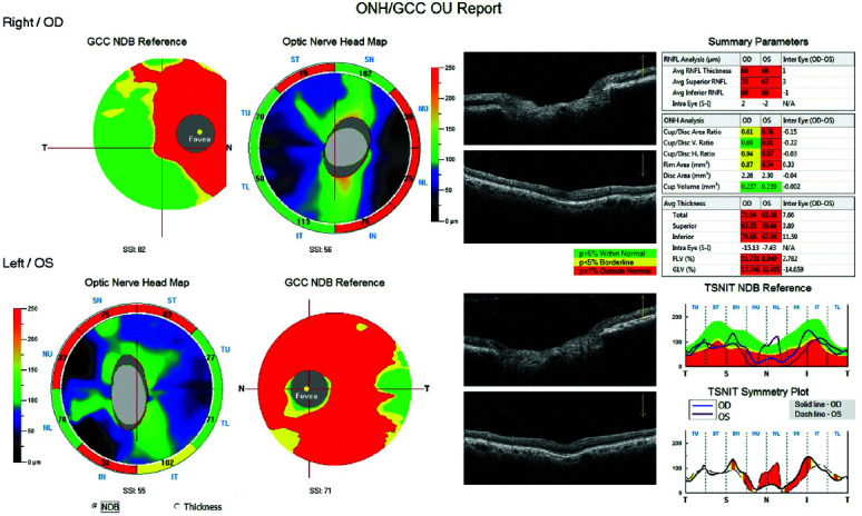 Fig. 3