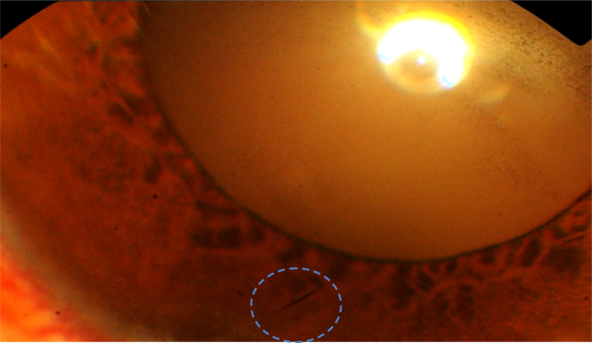 Fig. 3