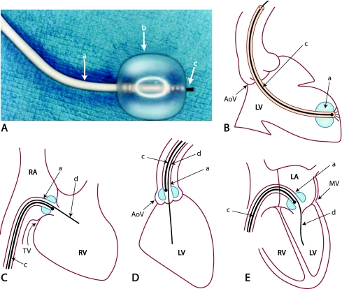 Fig. 1