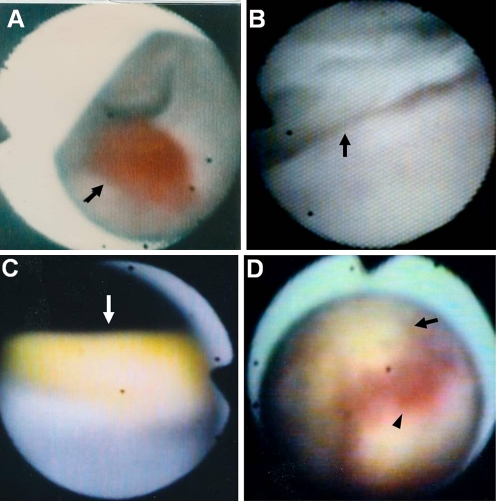 Fig. 4