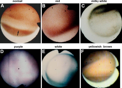 Fig. 3