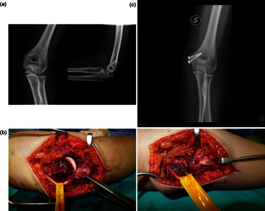 Fig. 1