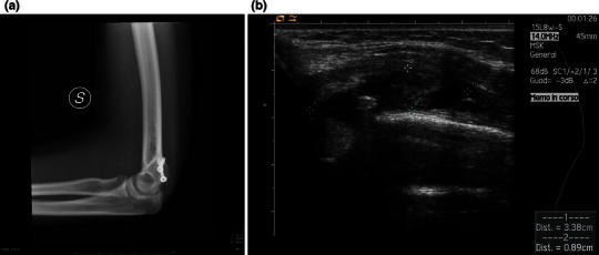 Fig. 2