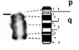 graphic file with name comparative_cytogenetics-13-001-i008.jpg