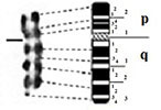 graphic file with name comparative_cytogenetics-13-001-i004.jpg